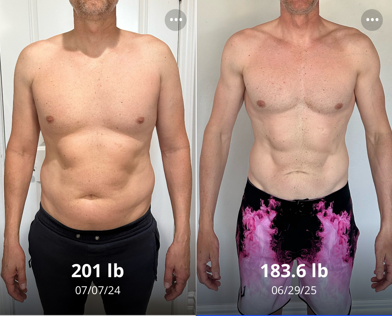 Client progress comparison showing front view